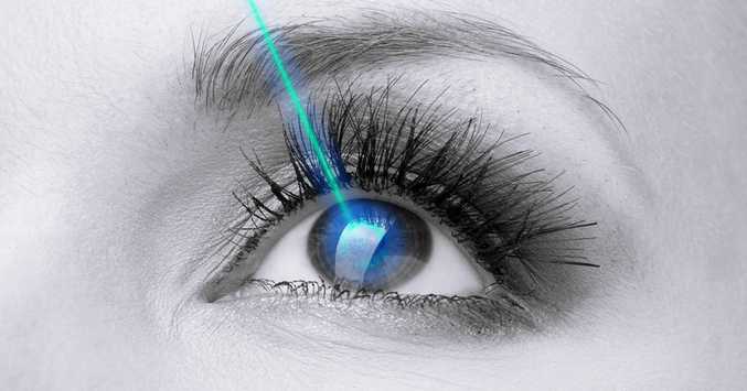 LASIK Eye Surgery Picture